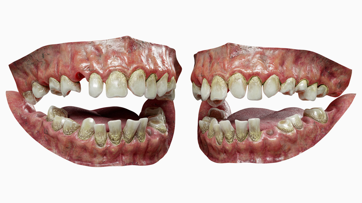 3D Teeth models