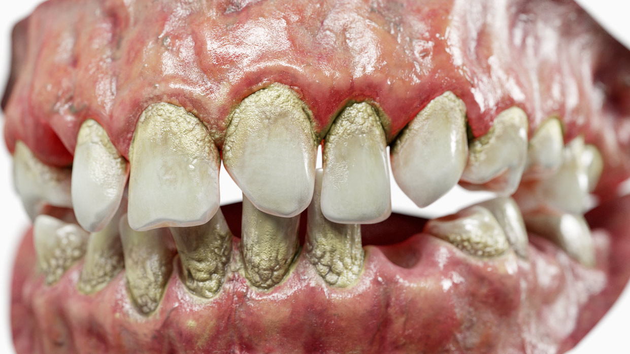 realistic 3d teeth model