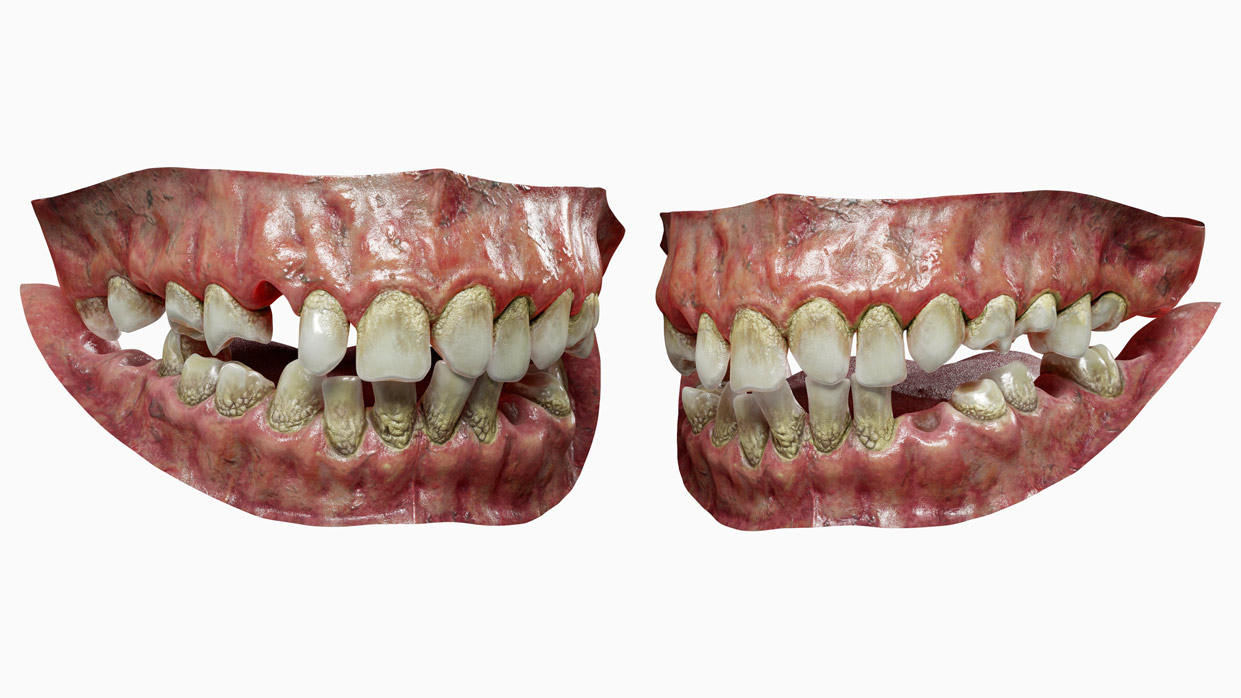 Download realistic 3d teeth model