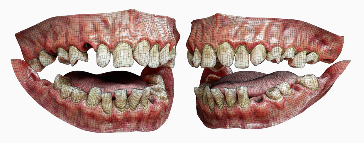 Teeth 3d wireframe model topology