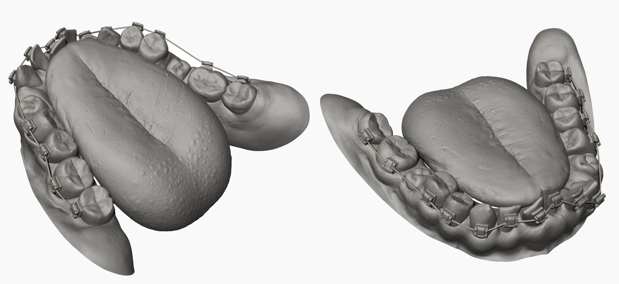 Tongue and teeth modelled in Zbrush 