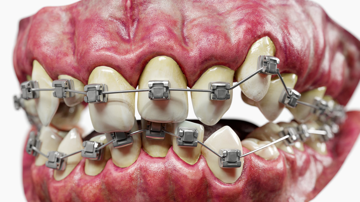 realistic 3d teeth model