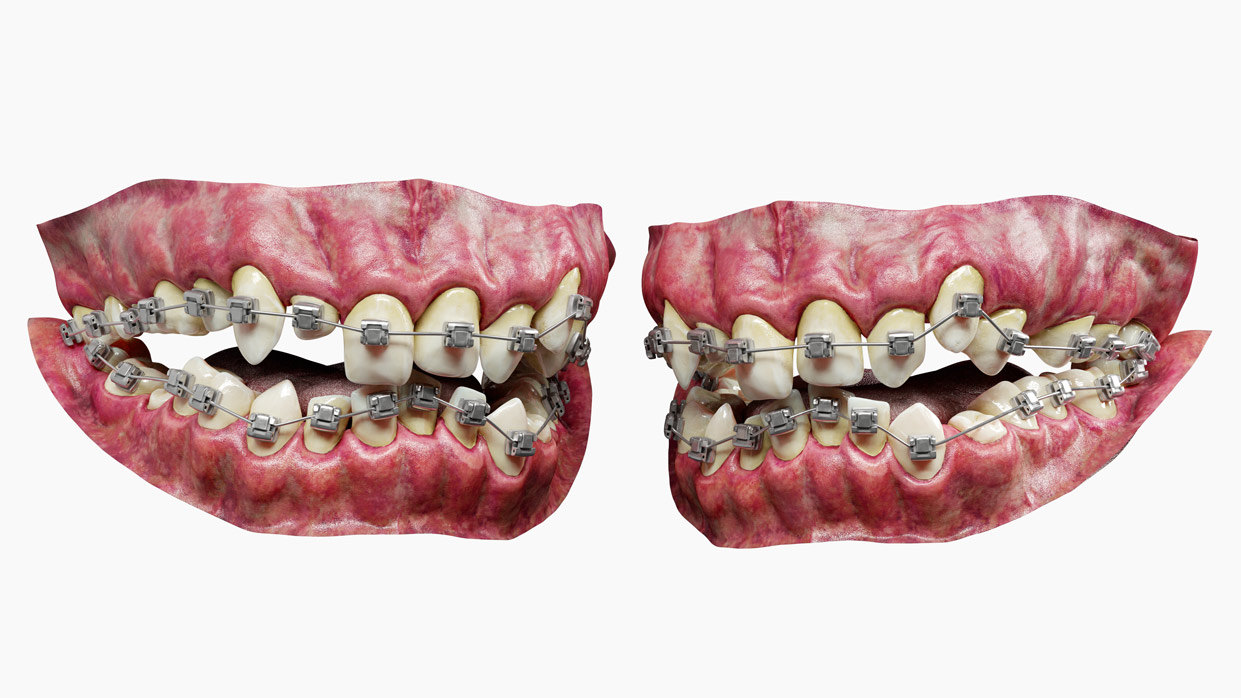 Download realistic 3d teeth model