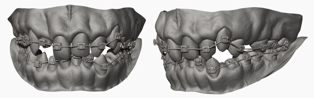 Teeth sculpt in Zbrush Model