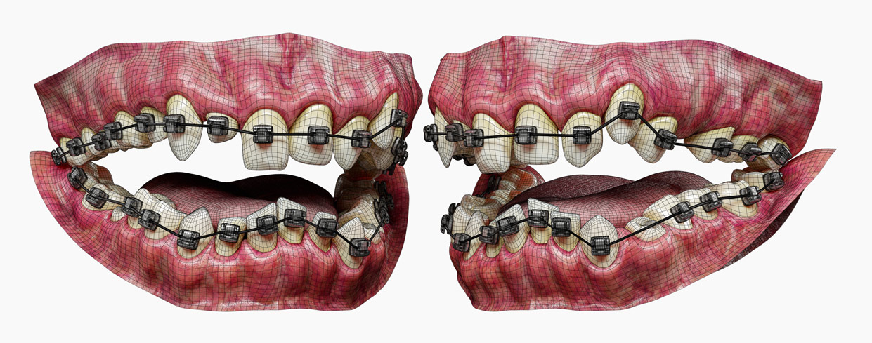 Teeth 3d wireframe model topology