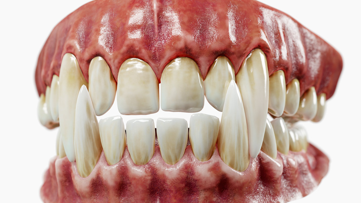 realistic 3d teeth model Vampire