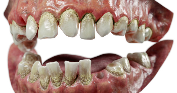 Realistic 3D Gnarly Rotten Teeth Model - Includes Blender, Marmoset ...