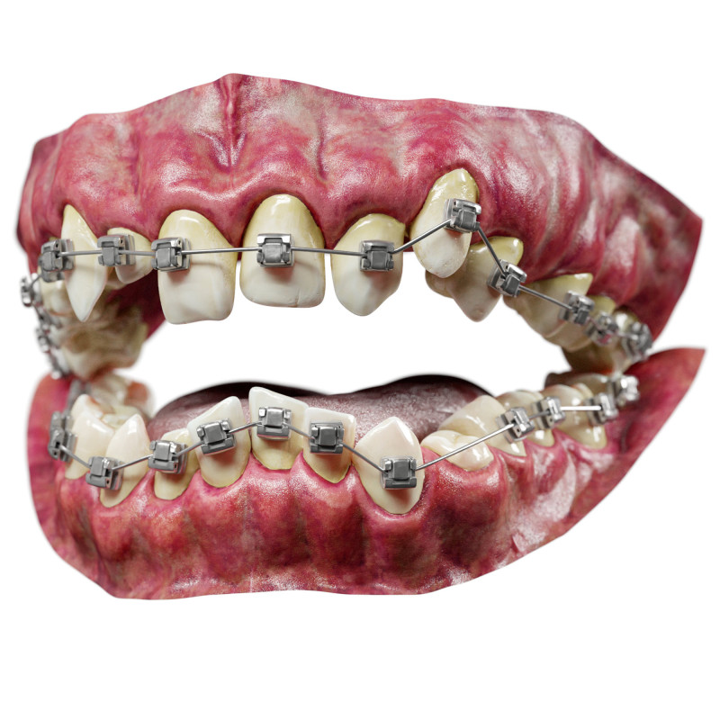 Realistic 3D Teeth with Braces - Includes Blender and Marmoset Scenes