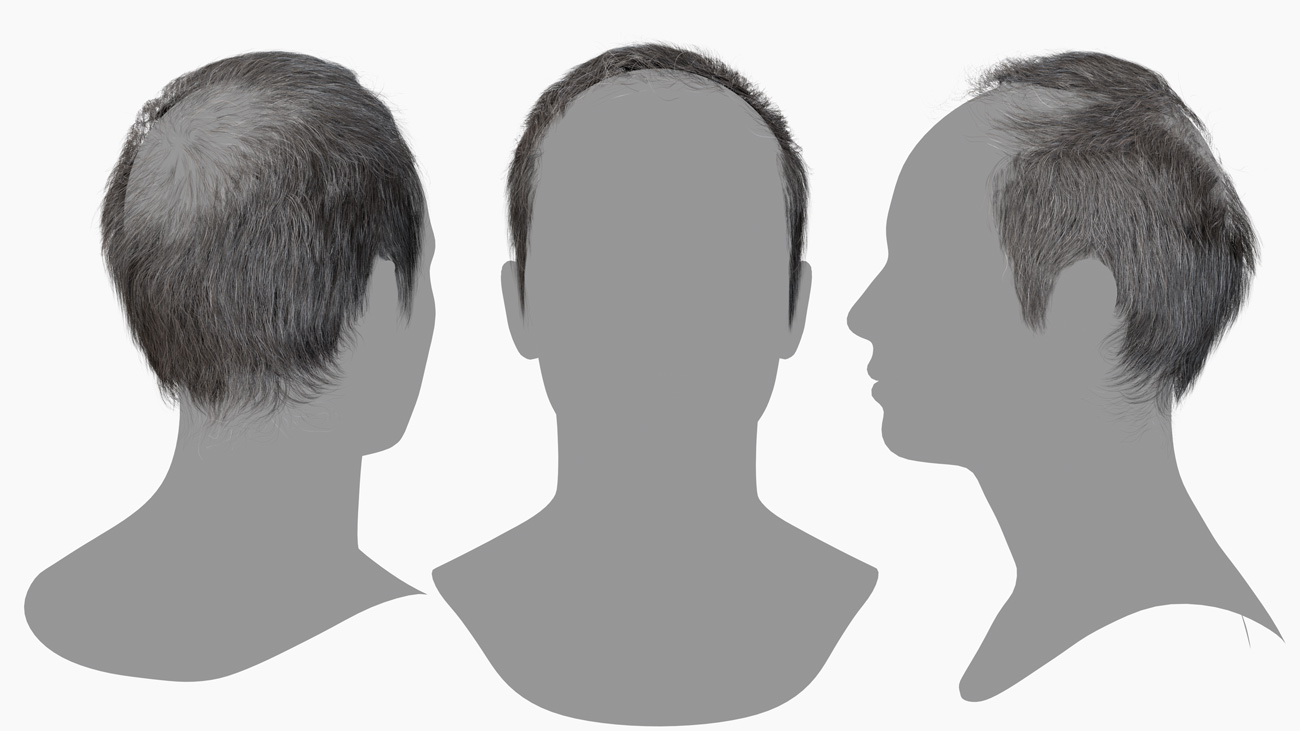 Male polygon hair style, Balding hair